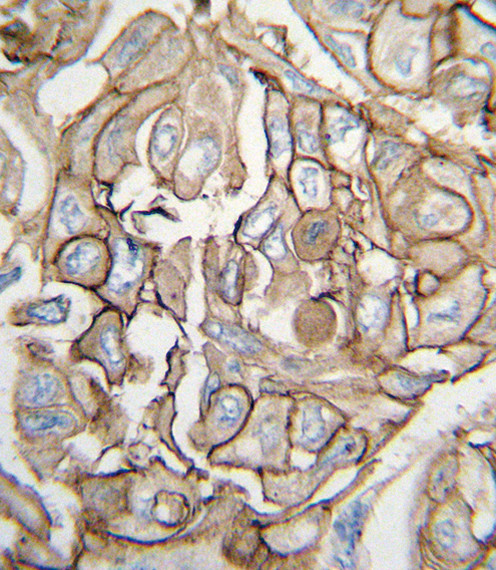 H-Ras Antibody in Immunohistochemistry (Paraffin) (IHC (P))