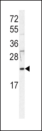 H-Ras Antibody in Western Blot (WB)