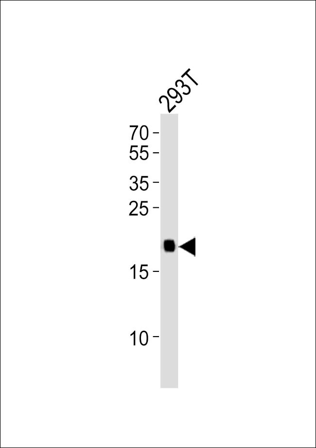 H-Ras Antibody in Western Blot (WB)