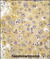 CTGF Antibody in Immunohistochemistry (Paraffin) (IHC (P))