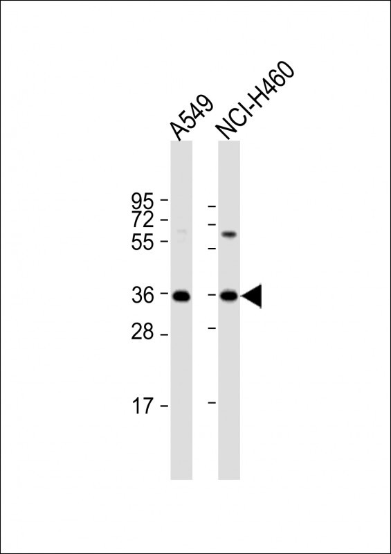 CTGF Antibody in Western Blot (WB)