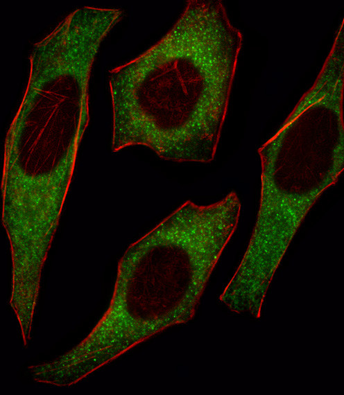 IRS2 Antibody in Immunocytochemistry (ICC/IF)