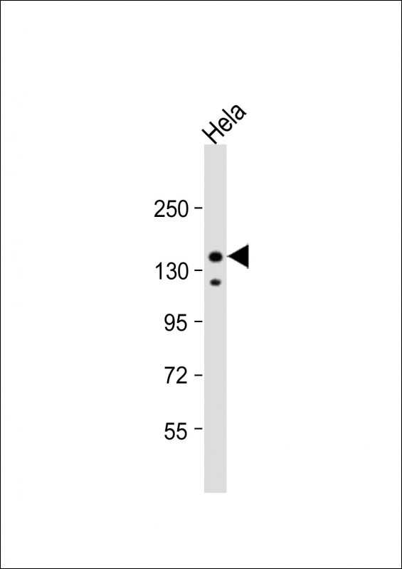 IRS2 Antibody in Western Blot (WB)