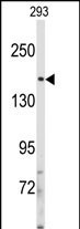 IRS2 Antibody in Western Blot (WB)