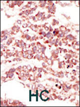 PTK7 Antibody in Immunohistochemistry (Paraffin) (IHC (P))