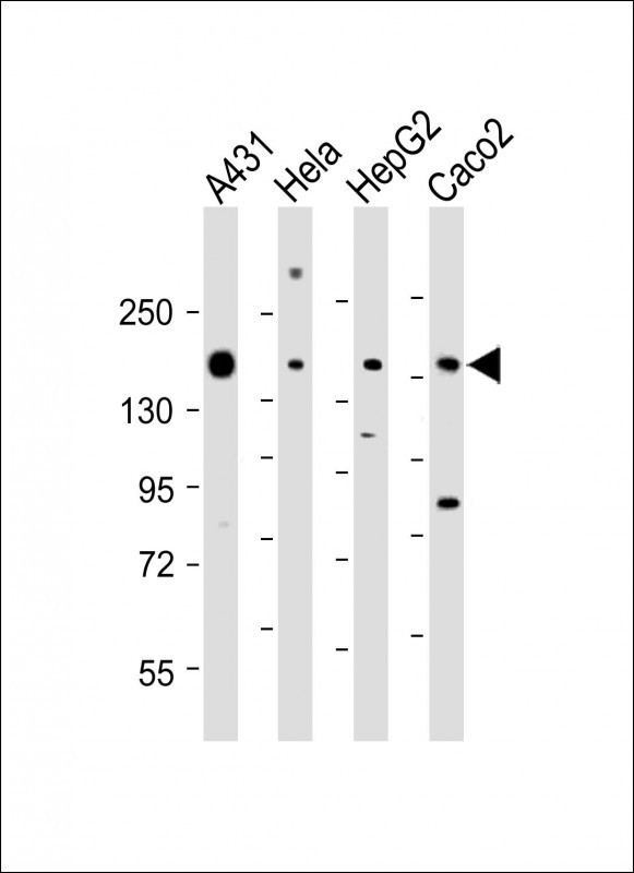 PTK7 Antibody in Western Blot (WB)