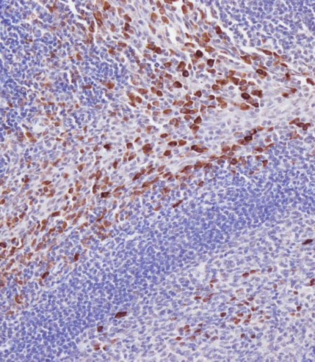 IRAK-M Antibody in Immunohistochemistry (Paraffin) (IHC (P))