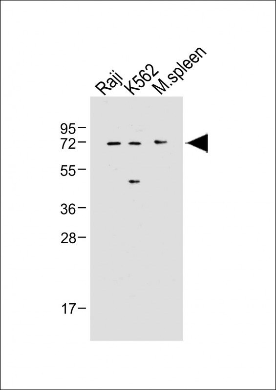 IRAK-M Antibody in Western Blot (WB)