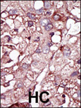ACVRL1 Antibody in Immunohistochemistry (Paraffin) (IHC (P))