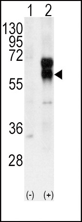 ACVRL1 Antibody in Western Blot (WB)