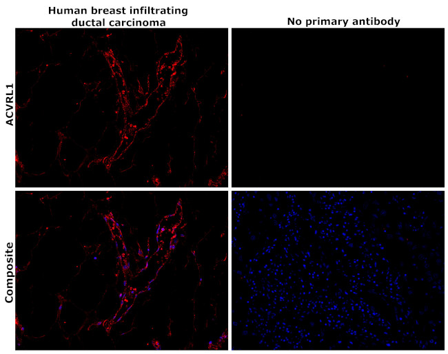 ACVRL1 Antibody in Immunohistochemistry (Paraffin) (IHC (P))