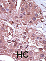 ACVRL1 Antibody in Immunohistochemistry (Paraffin) (IHC (P))