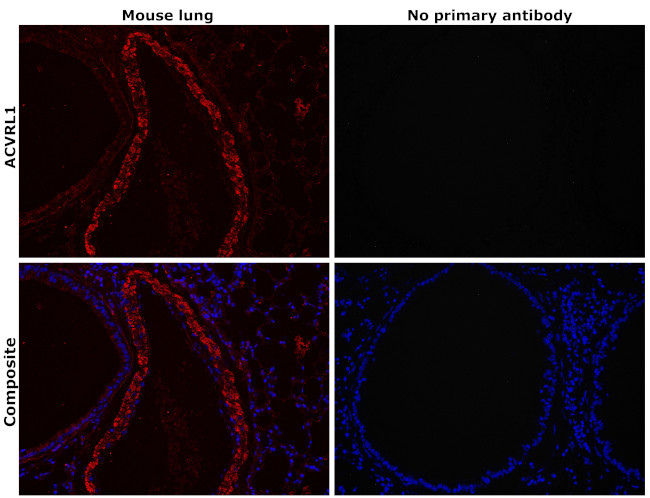 ACVRL1 Antibody in Immunohistochemistry (Paraffin) (IHC (P))