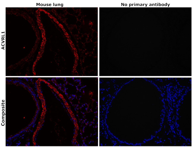 ACVRL1 Antibody in Immunohistochemistry (Paraffin) (IHC (P))