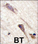 B-Raf Antibody in Immunohistochemistry (Paraffin) (IHC (P))