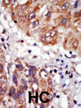 LIMK1 Antibody in Immunohistochemistry (Paraffin) (IHC (P))