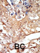 c-Raf Antibody in Immunohistochemistry (Paraffin) (IHC (P))