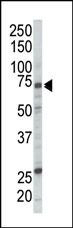 c-Raf Antibody in Western Blot (WB)