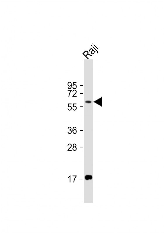 RIP2 Antibody in Western Blot (WB)