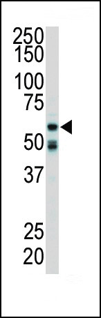 RIP2 Antibody in Western Blot (WB)