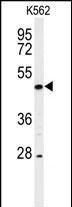 RIP3 Antibody in Western Blot (WB)