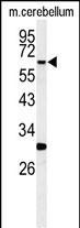 RIP3 Antibody in Western Blot (WB)