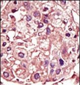 TGFBR1 Antibody in Immunohistochemistry (Paraffin) (IHC (P))