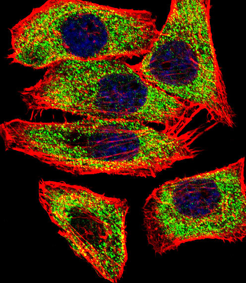 TGM2 Antibody in Immunocytochemistry (ICC/IF)