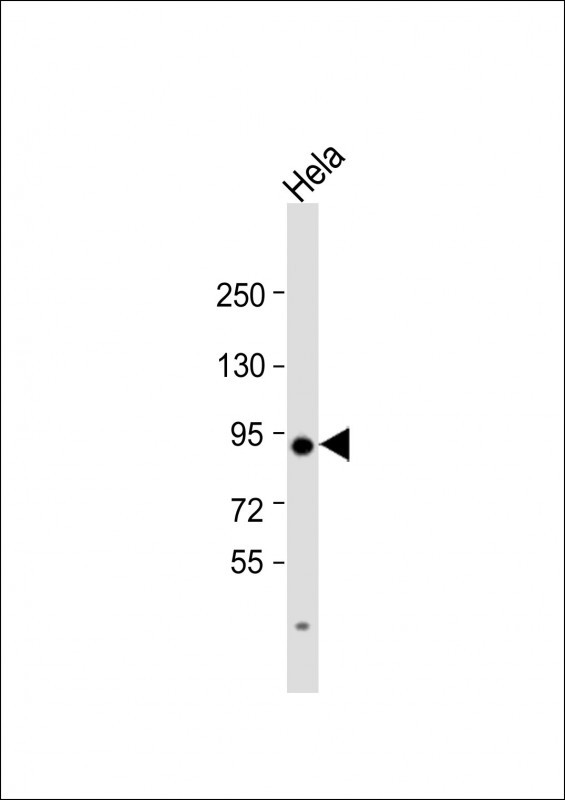 TGM2 Antibody in Western Blot (WB)