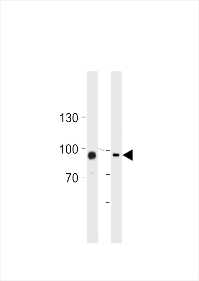 TGM2 Antibody in Western Blot (WB)