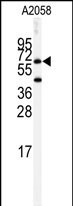 Butyrylcholinesterase Antibody in Western Blot (WB)