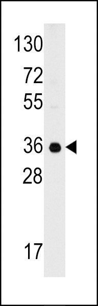 C1QBP Antibody in Western Blot (WB)