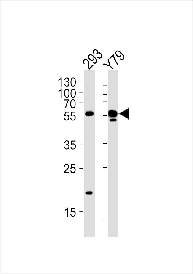 ALDH1A3 Antibody in Western Blot (WB)