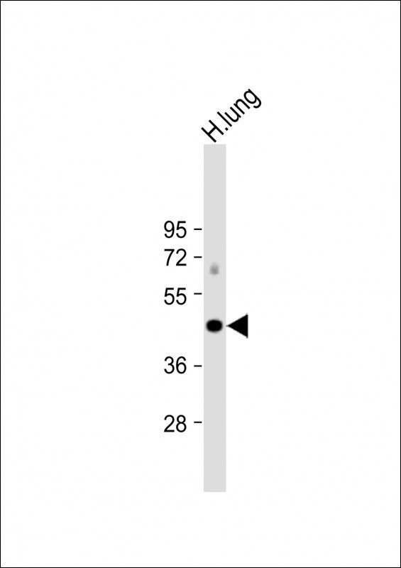 ALDH3A1 Antibody in Western Blot (WB)