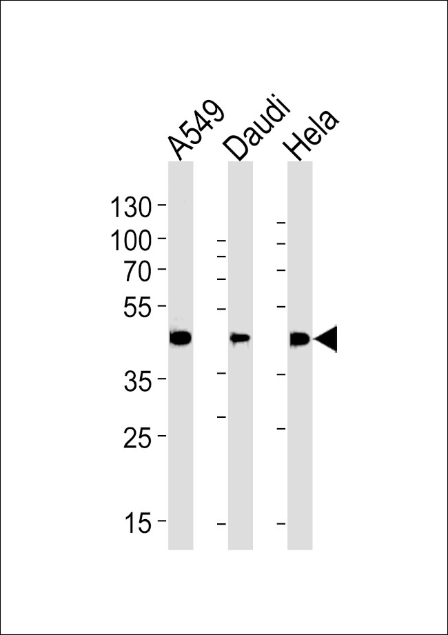 ALDH3A1 Antibody in Western Blot (WB)