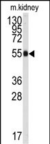 ALDH9A1 Antibody in Western Blot (WB)