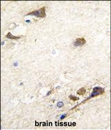 Acetylcholinesterase Antibody in Immunohistochemistry (Paraffin) (IHC (P))