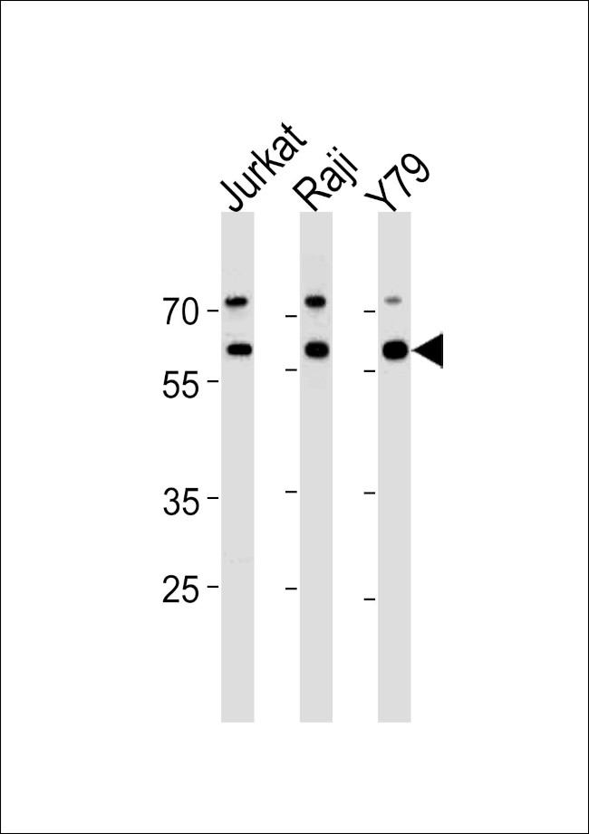 Acetylcholinesterase Antibody in Western Blot (WB)