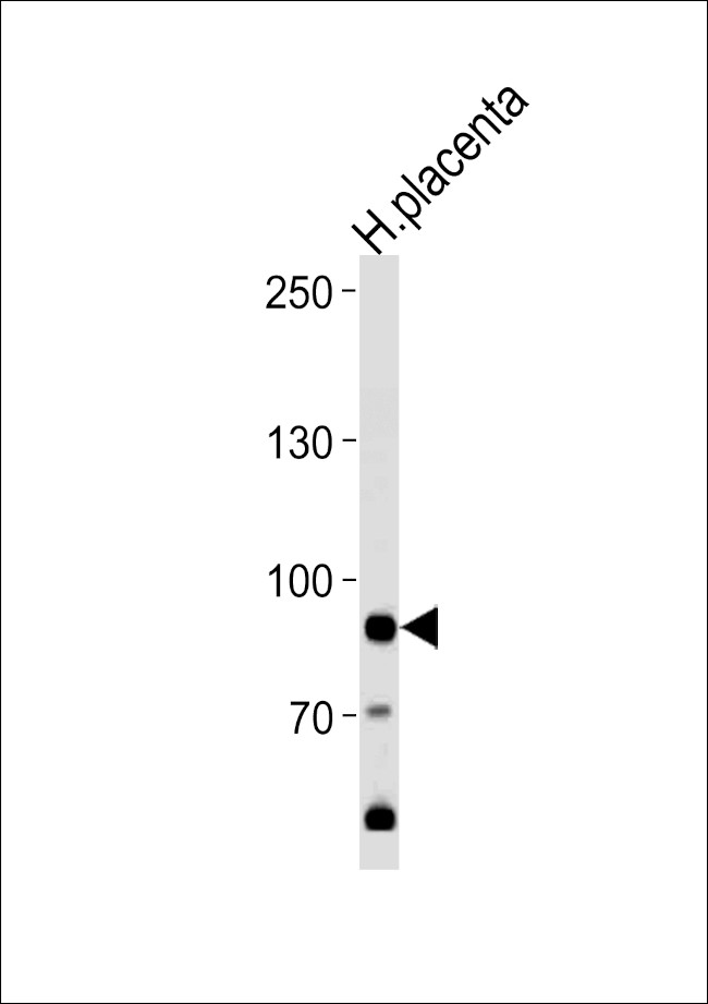 AMPD3 Antibody in Western Blot (WB)