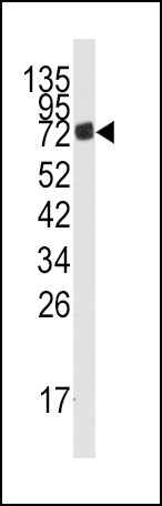 AMPD3 Antibody in Western Blot (WB)