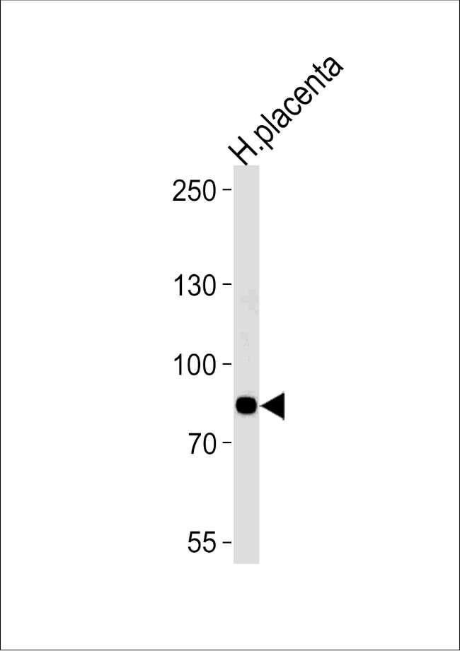 AMPD3 Antibody in Western Blot (WB)