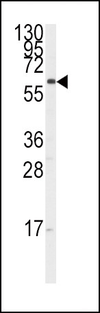 CYP17A1 Antibody in Western Blot (WB)