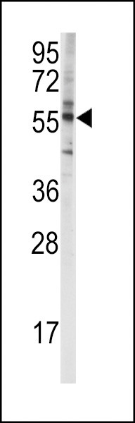 CYP4F8 Antibody in Western Blot (WB)
