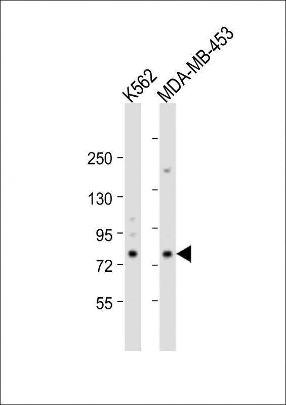 ALOX15 Antibody in Western Blot (WB)