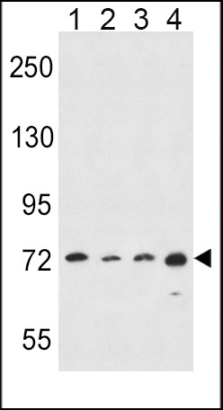 ALOX15 Antibody in Western Blot (WB)