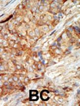 GCK Antibody in Immunohistochemistry (Paraffin) (IHC (P))