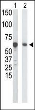 GCK Antibody in Western Blot (WB)