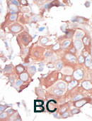 MEKK1 Antibody in Immunohistochemistry (Paraffin) (IHC (P))