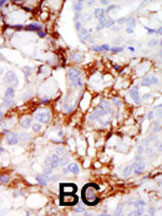 PAK3 Antibody in Immunohistochemistry (Paraffin) (IHC (P))