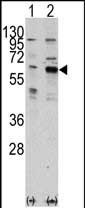 PAK3 Antibody in Western Blot (WB)